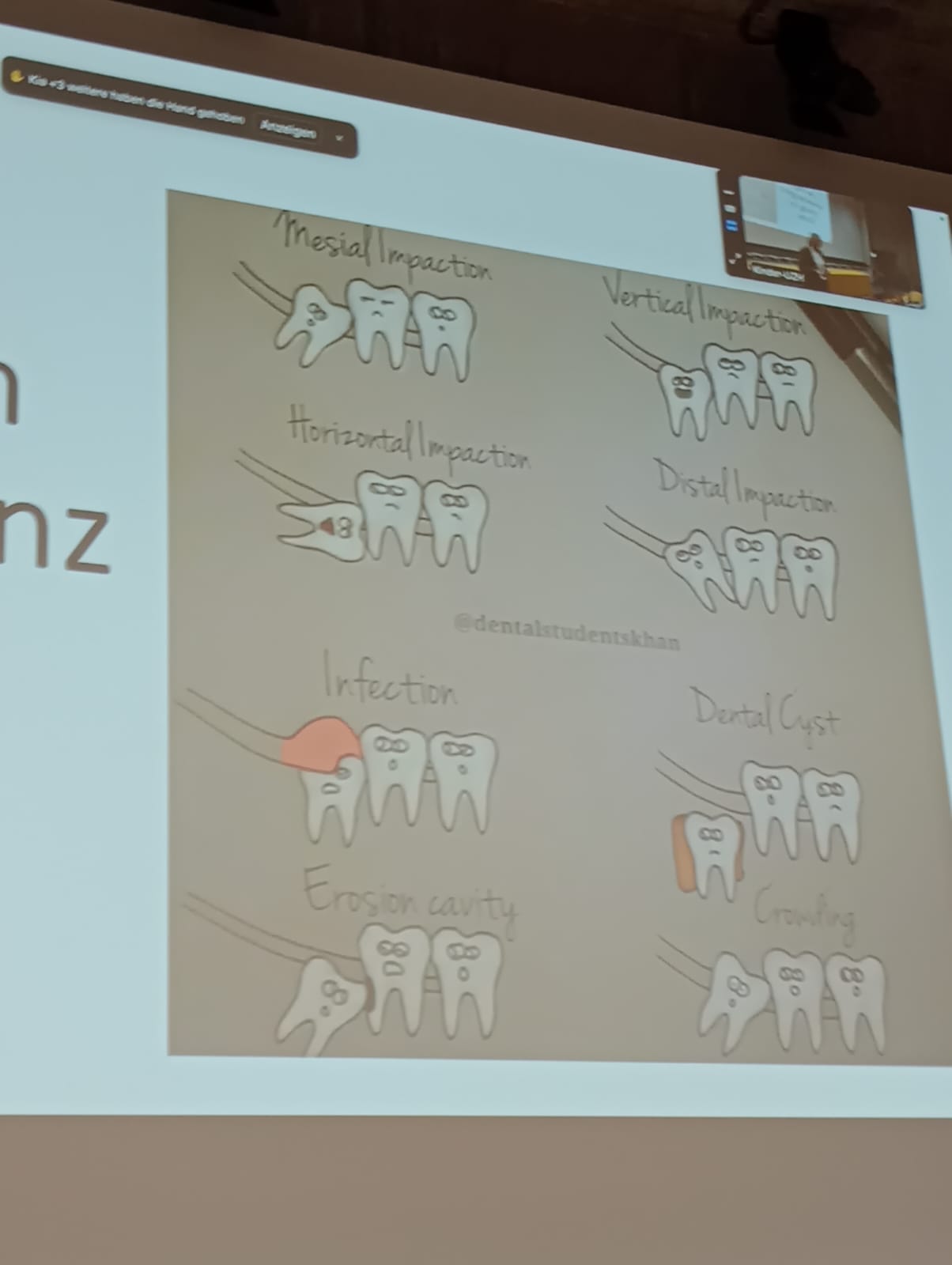 Zähne